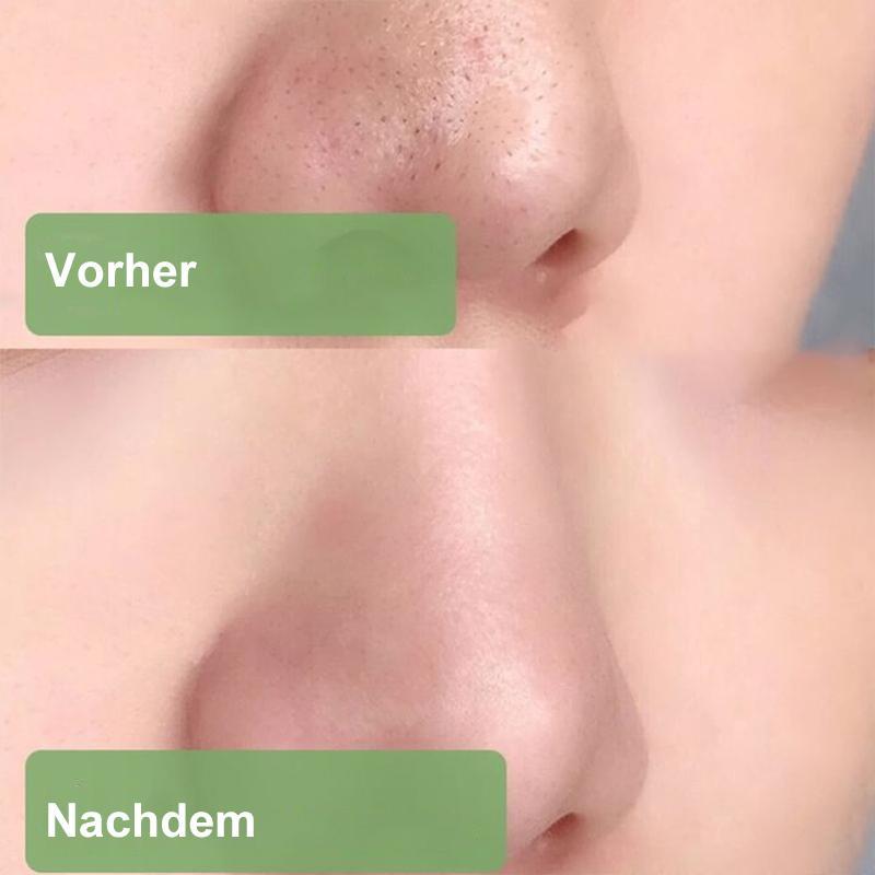 Porenlose Tiefenreinigungs-Grüntee-Maske